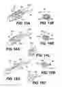 Fig. 16 - Obstructive sleep apnea treatment devices, systems and methods