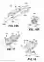 Fig. 17 - Obstructive sleep apnea treatment devices, systems and methods