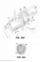 Fig. 19 - Obstructive sleep apnea treatment devices, systems and methods
