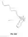 Fig. 25 - Obstructive sleep apnea treatment devices, systems and methods