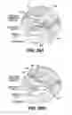 Fig. 31 - Obstructive sleep apnea treatment devices, systems and methods