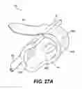 Fig. 33 - Obstructive sleep apnea treatment devices, systems and methods
