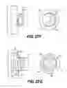 Fig. 36 - Obstructive sleep apnea treatment devices, systems and methods