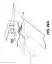 Fig. 43 - Obstructive sleep apnea treatment devices, systems and methods