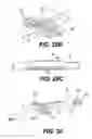 Fig. 44 - Obstructive sleep apnea treatment devices, systems and methods