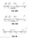 Fig. 49 - Obstructive sleep apnea treatment devices, systems and methods