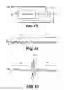 Fig. 59 - Obstructive sleep apnea treatment devices, systems and methods