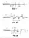 Fig. 60 - Obstructive sleep apnea treatment devices, systems and methods