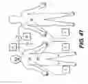 Fig. 61 - Obstructive sleep apnea treatment devices, systems and methods