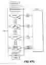 Fig. 64 - Obstructive sleep apnea treatment devices, systems and methods