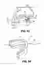 Fig. 85 - Obstructive sleep apnea treatment devices, systems and methods