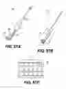 Fig. 87 - Obstructive sleep apnea treatment devices, systems and methods