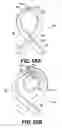 Fig. 88 - Obstructive sleep apnea treatment devices, systems and methods