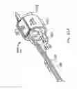 Fig. 91 - Obstructive sleep apnea treatment devices, systems and methods