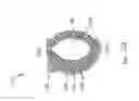 Fig. 92 - Obstructive sleep apnea treatment devices, systems and methods