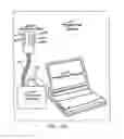 Fig. 99 - Obstructive sleep apnea treatment devices, systems and methods