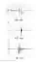 Fig. 10 - EXERCISE ANALYSIS DEVICE, EXERCISE ANALYSIS SYSTEM, EXERCISE ANALYSIS METHOD, AND PROGRAM