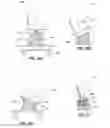 Fig. 24 - Exercise Systems, Exercise Devices and Exercise Methods
