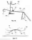 Fig. 07 - Slackline balance board