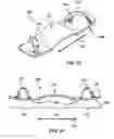 Fig. 14 - Slackline balance board
