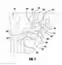 Fig. 08 - Plasma cutting torch, nozzle and shield cap