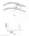 Fig. 07 - Method and system of assisting a driver of a vehicle