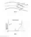 Fig. 04 - METHOD AND SYSTEM OF ASSISTING A DRIVER OF A VEHICLE