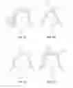 Fig. 08 - Steering knuckle apparatus for a vehicle