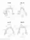 Fig. 08 - Steering knuckle apparatus for a vehicle