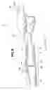Fig. 09 - Vehicle subframe