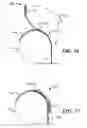 Fig. 10 - Combined back support and boarding ladder for an inflatable boat