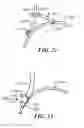 Fig. 13 - Combined back support and boarding ladder for an inflatable boat
