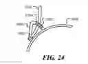 Fig. 14 - Combined back support and boarding ladder for an inflatable boat