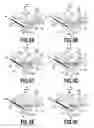 Fig. 10 - STACKING APPARATUS
