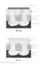 Fig. 03 - Method to improve cantilever process performance
