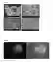 Fig. 03 - METHODS TO PRODUCE PARTICLES COMPRISING THERAPEUTIC PROTEINS
