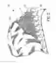 Fig. 03 - Absorbent Mat