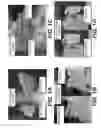 Fig. 02 - Method for enzymatic treatment of tissue products