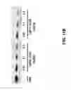 Fig. 16 - Lipid Formulated Compositions And Methods For Inhibiting Expression Of Transthyretin (TTR)