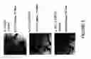 Fig. 06 - Composition and method for inner ear sensory hair cell regeneration and replacement