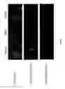 Fig. 02 - Antisense compounds and uses thereof