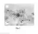 Fig. 02 - METHOD FOR DETECTION OF FETAL ABNORMALITIES