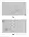 Fig. 03 - METHOD FOR DETECTION OF FETAL ABNORMALITIES