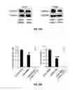 Fig. 15 - METHODS OF PROGNOSTICALLY CLASSIFYING AND TREATING GLANDULAR CANCERS