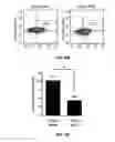 Fig. 17 - METHODS OF PROGNOSTICALLY CLASSIFYING AND TREATING GLANDULAR CANCERS