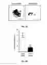 Fig. 18 - METHODS OF PROGNOSTICALLY CLASSIFYING AND TREATING GLANDULAR CANCERS