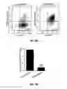 Fig. 26 - METHODS OF PROGNOSTICALLY CLASSIFYING AND TREATING GLANDULAR CANCERS