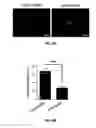 Fig. 27 - METHODS OF PROGNOSTICALLY CLASSIFYING AND TREATING GLANDULAR CANCERS