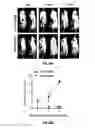 Fig. 28 - METHODS OF PROGNOSTICALLY CLASSIFYING AND TREATING GLANDULAR CANCERS