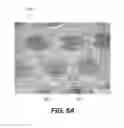 Fig. 09 - Absorbent sheet of cellulosic fibers having an upper side and a lower side with connecting regions forming a network interconnecting hollow domed regions